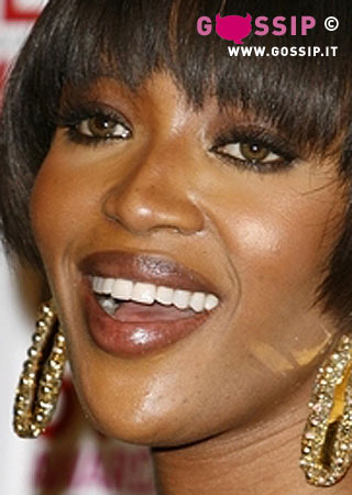 Naomi Campbell in ospedale