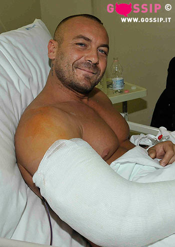Massimo GF10 col gesso in ospedale: foto
