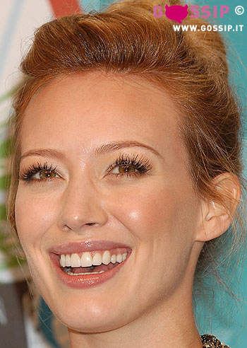 Hilary Duff: un dente scheggiato prima delle nozze