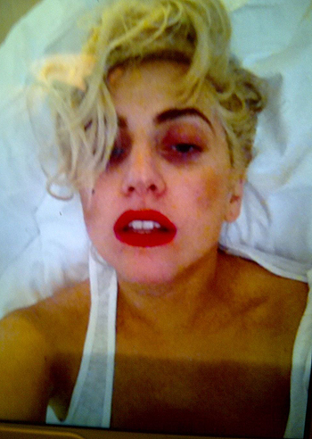 Lady Gaga, tumefatta su Twitter