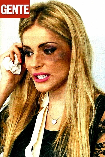 Francesca Cipriani tumefatta: "Lele Mora mi ha picchiato"
