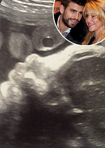 La prima foto del figlio di Shakira e Piqué