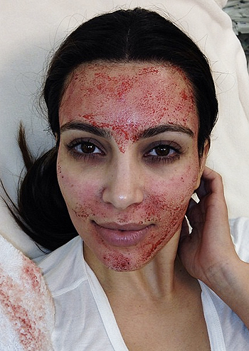 Kim Kardashian, faccia da vampiro per bellezza
