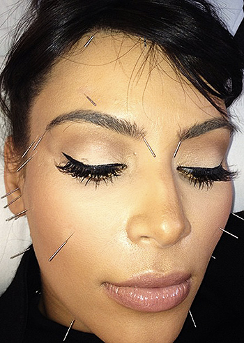 Kim Kardashian coperta di aghi