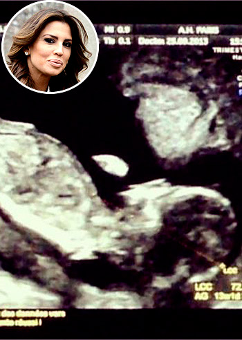 Claudia Galanti, l'ecografia del bebè