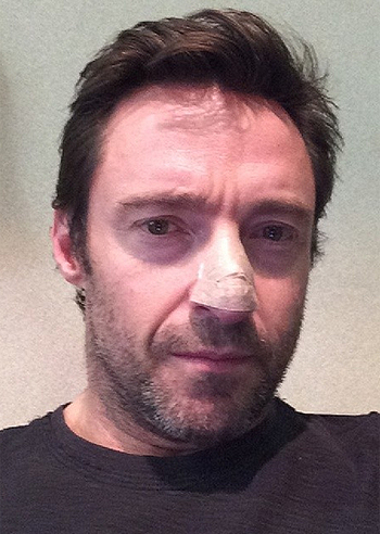 Hugh Jackman, un tumore sul naso