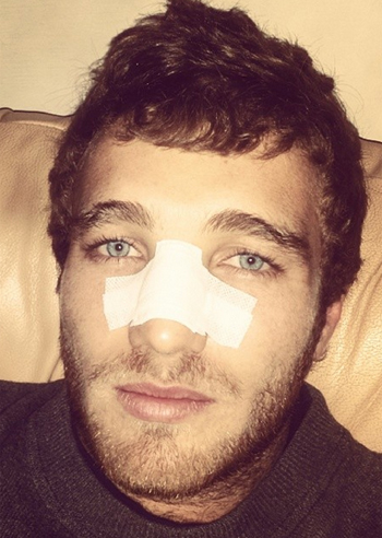 Paolo Ciavarro, cosa ha fatto al naso? Paolo Ciavarro, cosa ha fatto al naso?