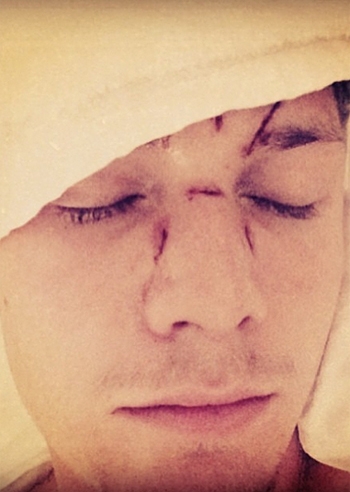 Il fratello di Paris Hilton, Barron, picchiato a Miami