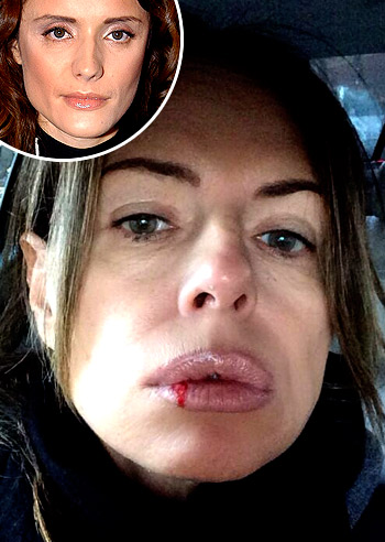 Michela Rocco di T.: 'Perego labbra a canotto'