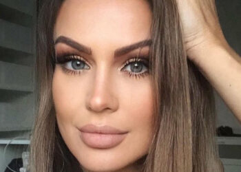 Eva Henger dopo l’incidente. ''Piango spesso, a volte ho dolori allucinanti e…''