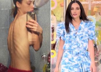 Rosalinda Cannavò pubblica le foto di quando era anoressica: ''Pesavo 32 chili e...''