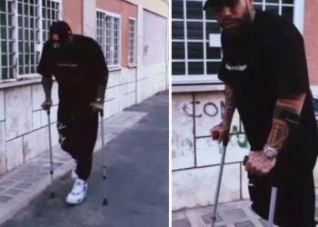 Francesco Chiofalo cammina a fatica con le stampelle: ecco come sta dopo l’intervento