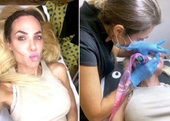 Ilary Blasi, forse ferita nell'orgoglio dopo il tradimento, vuole essere la più bella: nuovo trattamento labbra