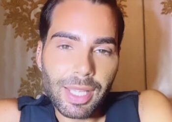 Federico Fashion Style ammette che l’intervento estetico è stato pesante: ''Non solo addominoplastica''