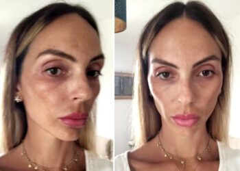 Sarah Nile irriconoscibile, mostra gli effetti della PMA per rimanere incinta: ''Questa sono io''