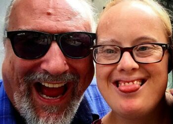 Eugenio Finardi parla della figlia con la sindrome di Down: 'Ecco dove vive oggi a 40 anni'