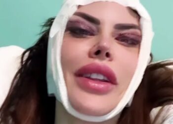 Guendalina Tavassi si mostra appena uscita dalla sala operatoria dopo un nuovo intervento di chirurgia plastica: ''Ecco cos'ho rifatto''