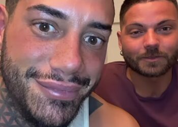 ''Vi presento il mio assistente personale, guardate la sua cicatrice'': Francesco Chiofalo mostra il collaboratore conosciuto grazie al tumore