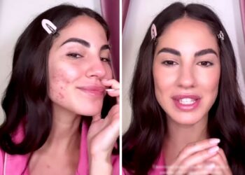 ''Ho avuto uno sfogo tremendo, mi vedo proprio brutta'': Giulia De Lellis mostra il ritorno dell'acne sul suo viso