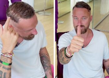 ''Abbiate il coraggio di dirlo'': Francesco Facchinetti mostra la nuova protesi per capelli e invita altri vip al coming out