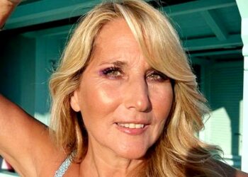 ''Naso rotto, cicatrice, due punti in testa'': Jo Squillo e la sorella gemella