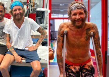 ''Durante l’operazione si sono dimenticati di riallineare il femore, ho una gamba più corta'': la rivelazione sconcertante di Jovanotti