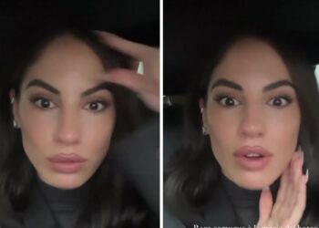 Giulia De Lellis confessa di fare il botox al viso