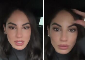 ''Faccio il Botox, la gente mente'': Giulia De Lellis confessa di andare dal medico estetico a fare le punturine sulla fronte