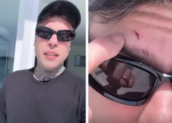 Fedez da solo a Miami senza Chiara Ferragni e i figli: il rapper ha avuto un piccolo incidente