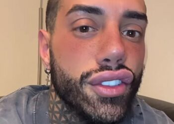 Francesco Chiofalo rivela che tutti gli hanno sconsigliato di fare l'intervento per cambiare colore degli occhi