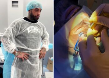 Francesco Chiofalo mostra le immagini impressionanti dell'operazione per cambiare colore degli occhi
