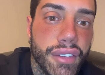 Francesco Chiofalo annuncia: 'Sto per fare fare l'operazione che cambierà colore ai miei occhi'