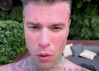 Fedez in vacanza a Miami si brucia la pelle dimenticando di mettere la protezione solare