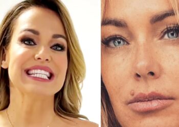 ''A me sembra di essere stata sempre così, senza neo'': Sonia Bruganelli parla del suo ultimo intervento estetico fatto