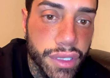 ''So che sarò sommerso di critiche'': Francesco Chiofalo annuncia nuovo intervento di chirurgia estetica, ecco cosa farà