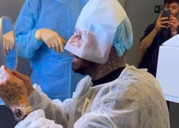 Francesco Chiofalo al controllo dopo l'intervento di cambio colore degli occhi