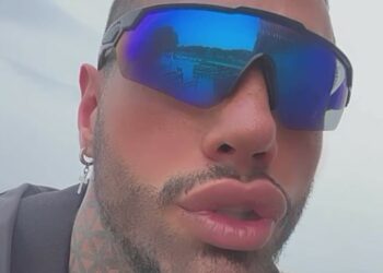 Francesco Chiofalo spiega perchè non mostrerà i risultati dell'intervento del cambio colore degli occhi