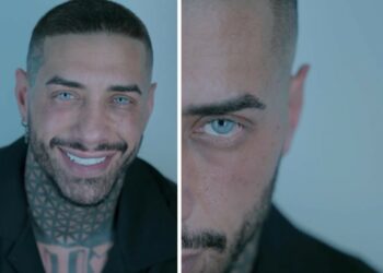 Francesco Chiofalo mostra per la prima volta gli occhi azzurrissimi dopo l'operazione per il cambio colore: guarda
