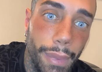 Francesco Chiofalo dopo aver cambiato colore degli occhi vuole fare l'allungamento delle gambe