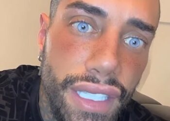 ''Mi piacerebbe fare l’intervento per allungare le gambe'': Francesco Chiofalo dopo aver cambiato colore degli occhi punta a una nuova operazione estetica