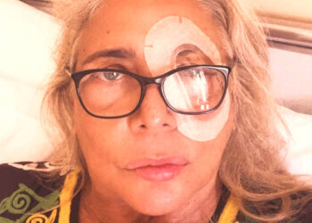 'Mai tranquilla': Mara Venier in clinica con l'occhio bendato, cos'è successo? Ecco cosa ha detto il marito...
