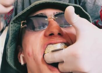 Achille Costacurta si fa fare il grillz