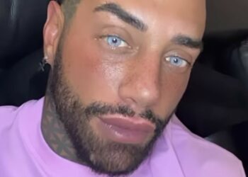 ''Non posso viaggiare fuori dall’Italia'': Francesco Chiofalo spiega il problema dopo l’ultimo intervento estetico