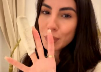 Giulia De Lellis mostra il dito dopo l'infortunio