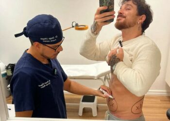 L'ex naufrago Andrea Cerioli si è sottoposto a una liposuzione: le immagini e il motivo dell'intervento estetico