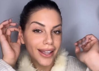 ''Il risultato è fenomenale'': Antonella Fiordelisi eccitata per il suo nuovo seno a 4 giorni dal nuovo intervento di mastoplastica