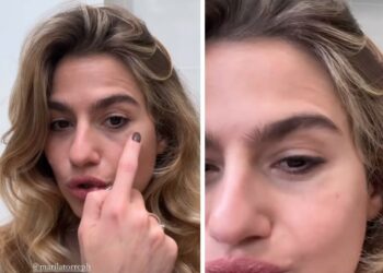 ''Mi ha spaccato la macchina fotografica in faccia'': Cristina Marino mostra l’occhio nero