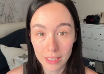 Aurora Ramazzotti svela come ha raggiunto l'equilibrio con Goffredo grazie alla terapia