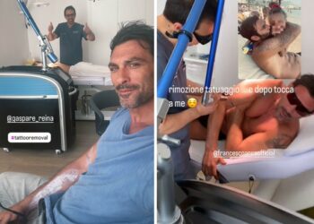 Francesca Arca sta rimuovendo i tatuaggi tribali da 'tronista' che aveva da decenni sul braccio: guarda