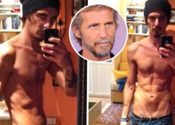 ''Assumevo 270 calorie al giorno, pesavo 51 kg'': Laerte Pappalardo, figlio di Adriano ed ex marito della Lucarelli, mostra le foto e racconta la malattia